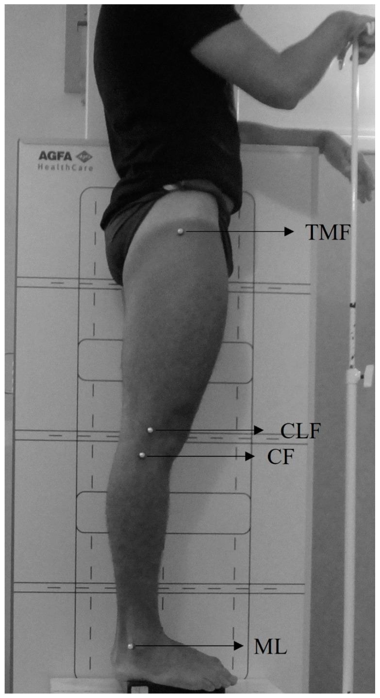 Concurrent Validity of Three Photogrammetric Methods for Assessing Knee Alignment in Sagittal Plane.