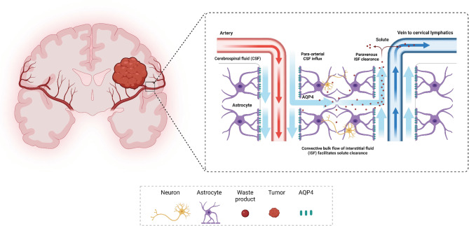 Glymphatic system dysfunction and cerebrospinal fluid retention in gliomas: evidence from perivascular space diffusion and volumetric analysis.
