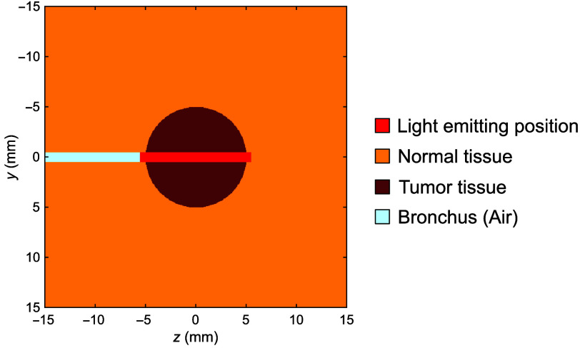 Optical characteristics of human lung cancer for photodynamic therapy with measured absorption and reduced scattering coefficients.