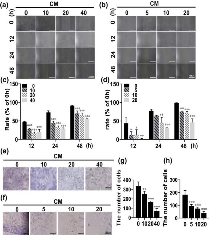Dihydroartemisinin inhibits melanoma migration and metastasis by affecting angiogenesis.