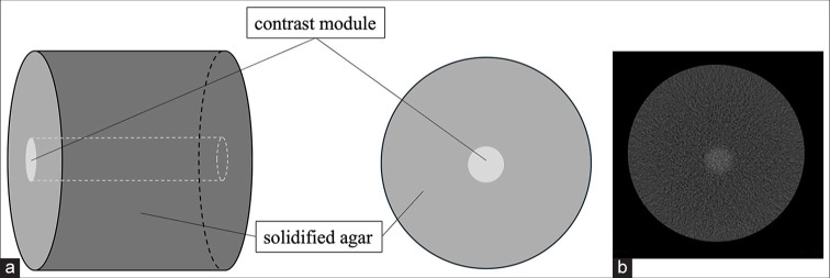 Usefulness of high tube voltage conditions in CT Fluoroscopy during CT-guided biopsy: Preliminary study.