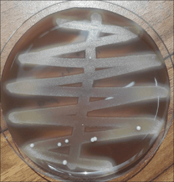 Detection and quantification of <i>Fusobacterium nucleatum</i> and <i>Porphyromonas gingivalis</i> in salivary samples of gutka and non-gutka users- 'A pilot study'.