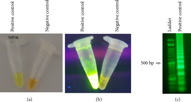 Development of a Novel Nested-RT-LAMP Assay for the Rapid and Accurate Coronavirus Disease-2019 Diagnosis.