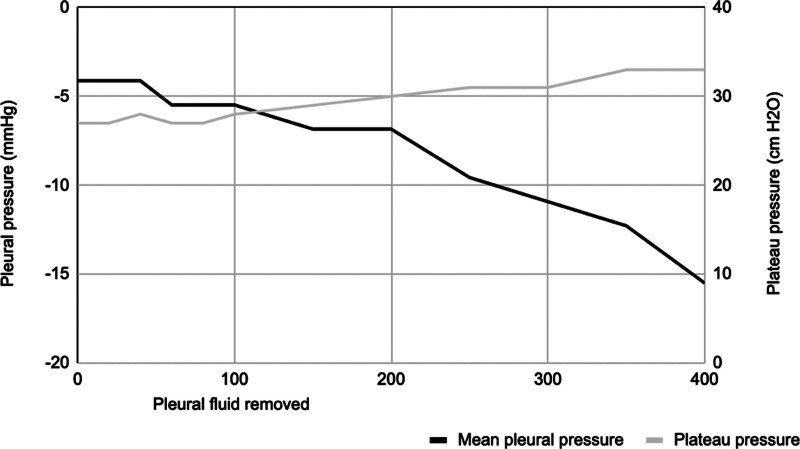 Invasive Pleural Manometry to Explore the Physiology Behind Paradoxical Compliance Response to Abdominal Compression-A Case of "Unexpandable" Lung in Acute Respiratory Distress Syndrome.