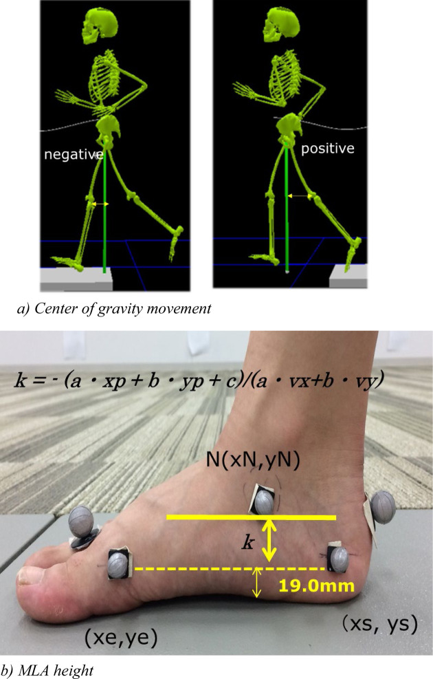 Morphological analysis of the windlass mechanism during running.