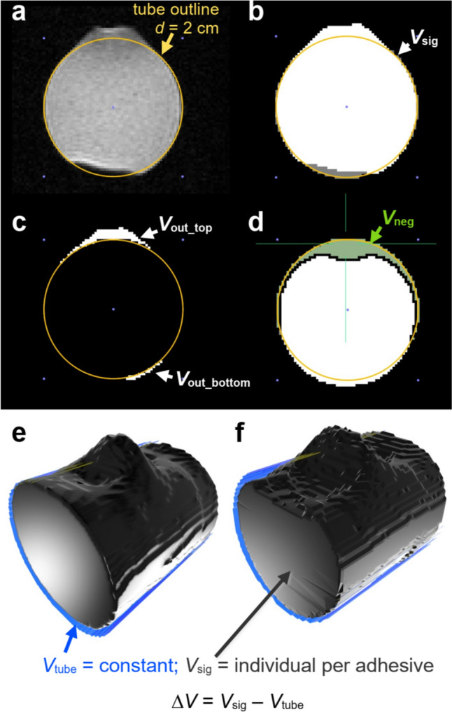Systematic evaluation of adhesives for implant fixation in multimodal functional brain MRI.