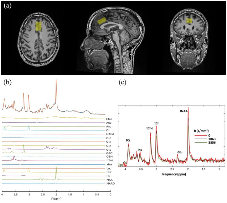 Neuroimmunometabolic alterations and severity of depressive symptoms in people with HIV: An exploratory diffusion-weighted MRS study.