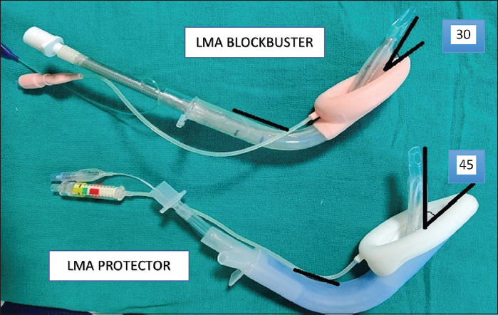 Comparison of blind oro-tracheal intubation through LMA Blockbuster and LMA Protector - A prospective randomized study.