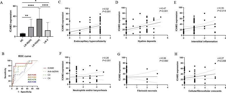 Proteomics uncovers ICAM2 (CD102) as a novel serum biomarker of proliferative lupus nephritis.