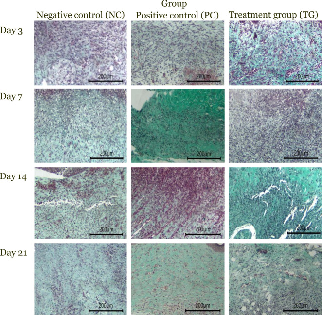 Effect of hemp seed oil on accelerating wound healing: Evaluation of wound size reduction, epithelialization, granulation tissue formation, and vascularization in murine models.