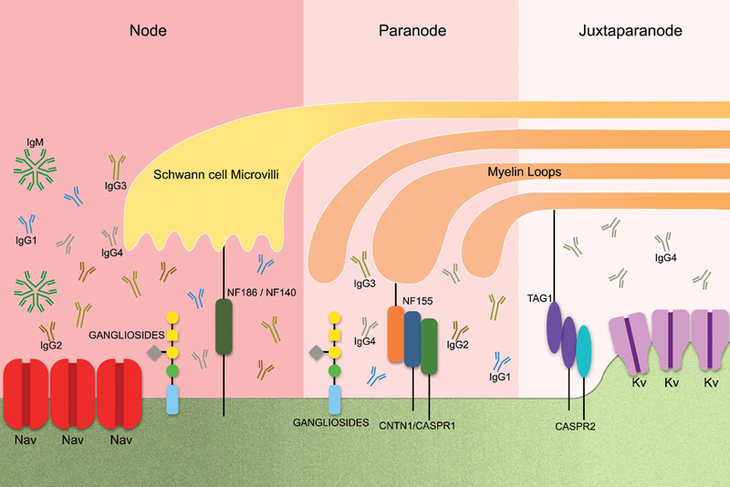 Immune-mediated insights into clinical and specific autoantibodies in acute and chronic immune-mediated nodo-paranodopathies.