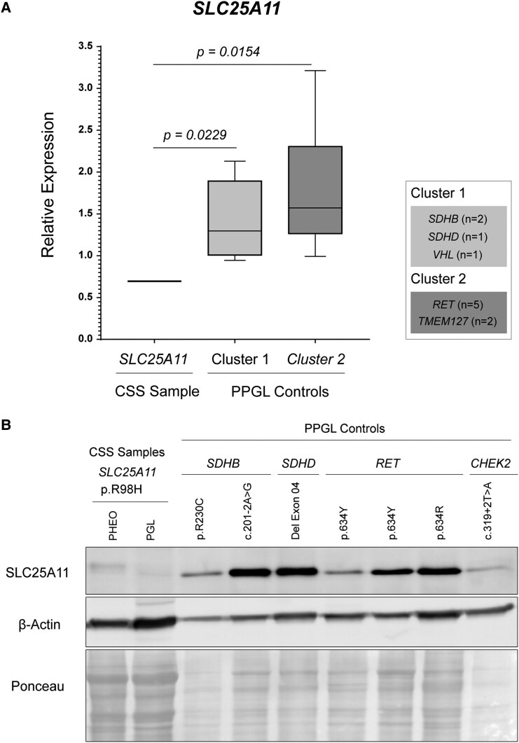 <i>SLC25A11</i>, a Novel Gene Associated With Carney-Stratakis Syndrome.