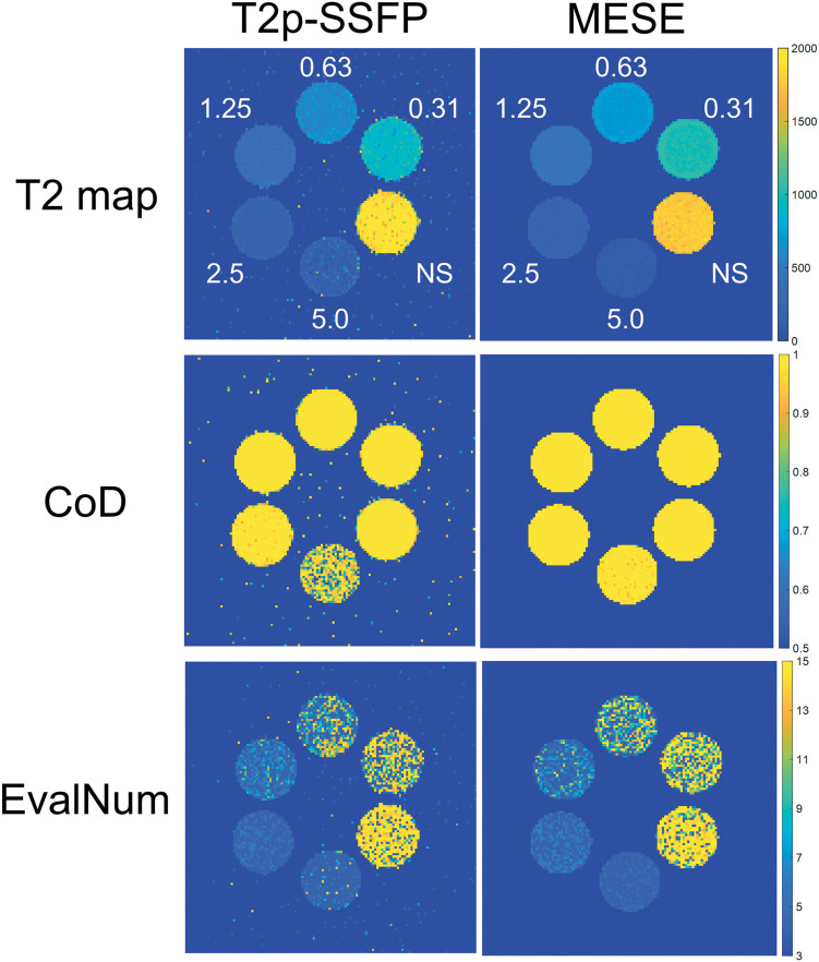 Imaging of <sup>17</sup>O-labeled Water Using Fast T2 Mapping with T2-preparation: A Phantom Study.