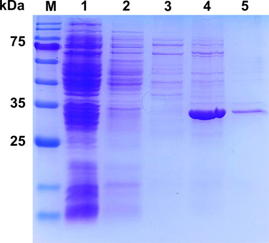 Mining Arylsulfatase from Genome-Scale Metabolic Pathways of Pseudoalteromonas sp. SR43-6 and Its Agar-Based Desulfurization Applications.