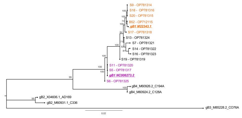 Feasibility of using saliva for Cytomegalovirus detection and genotyping in pediatric hematopoietic stem cell transplant recipients.