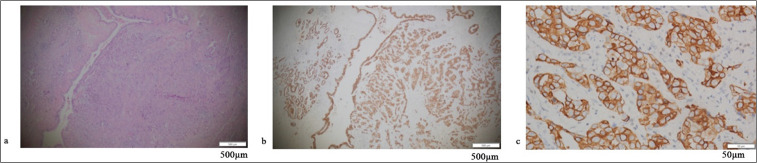 Expression and clinical significance of programmed cell death protein 1/programmed death-ligand 1 in non-small cell lung cancer patients with rare mutations of epidermal growth factor receptor gene: A retrospective cohort study.