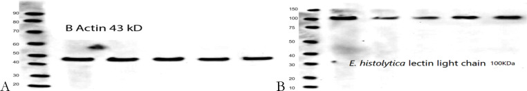 Presence and Interactions of <i>Entamoeba histolytica</i> Lectin and <i>p53</i> Protein in Colorectal Cancer.