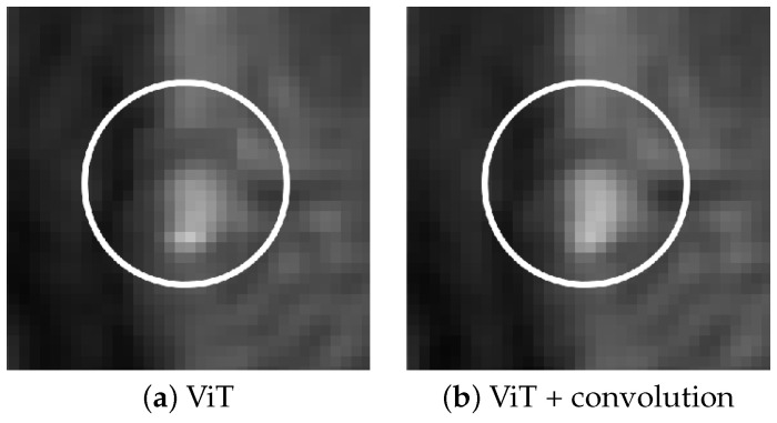 Rosette Trajectory MRI Reconstruction with Vision Transformers.