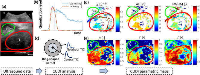 Contrast-ultrasound dispersion imaging for renal cell carcinoma diagnostics.
