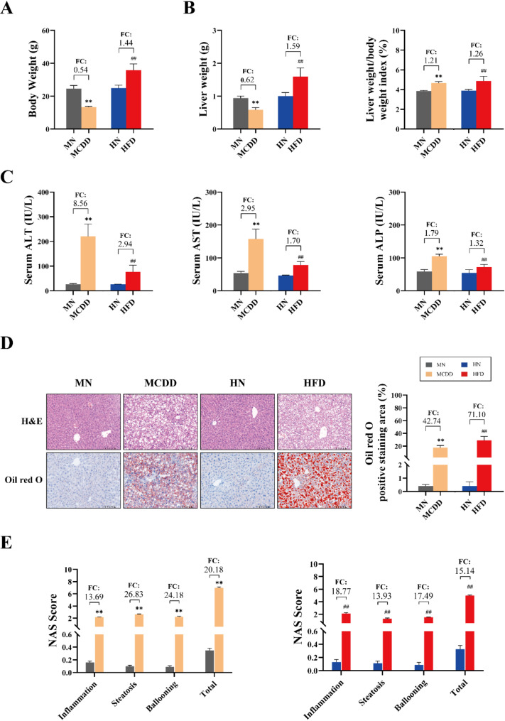 Differences in Fatty Acid Metabolism between MCDD and HFD Induced Metabolic Dysfunction-associated Fatty Liver Disease Model Mice.