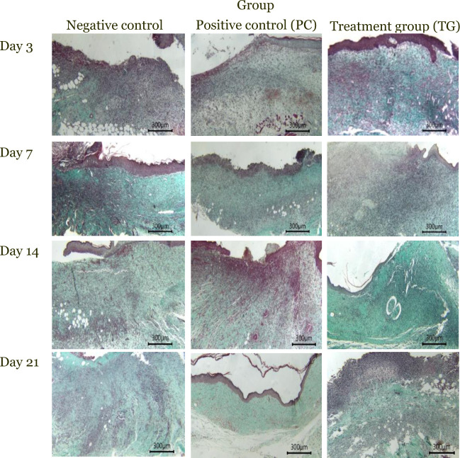 Effect of hemp seed oil on accelerating wound healing: Evaluation of wound size reduction, epithelialization, granulation tissue formation, and vascularization in murine models.