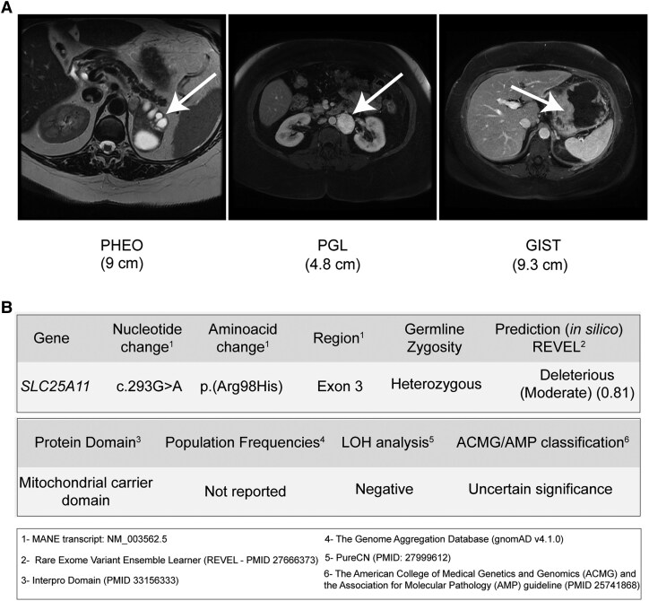 <i>SLC25A11</i>, a Novel Gene Associated With Carney-Stratakis Syndrome.