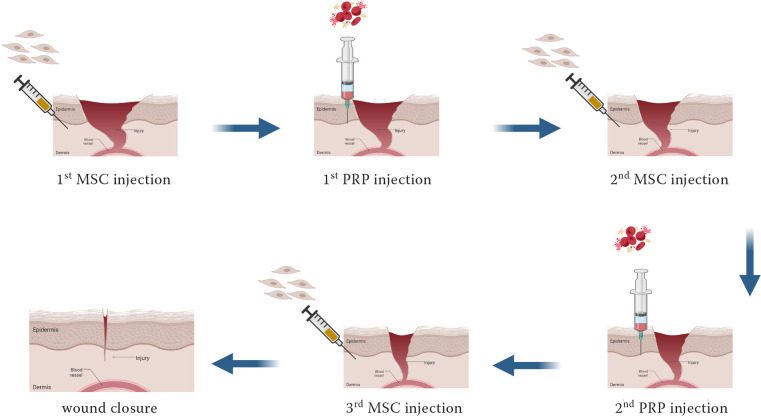 Allogeneic adipose MSCs and autologous PRP for chronic non-healing wound in a cat.