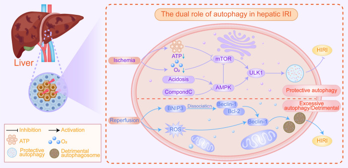 Autophagy: a double-edged sword in ischemia-reperfusion injury.