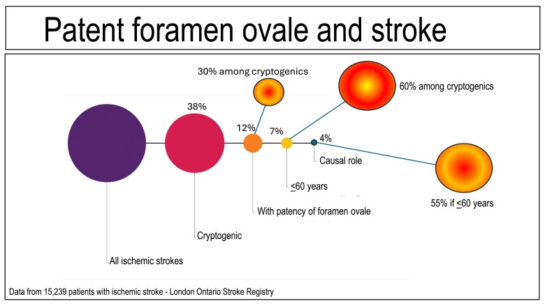 Cryptogenic stroke: too many suspects to find a culprit?