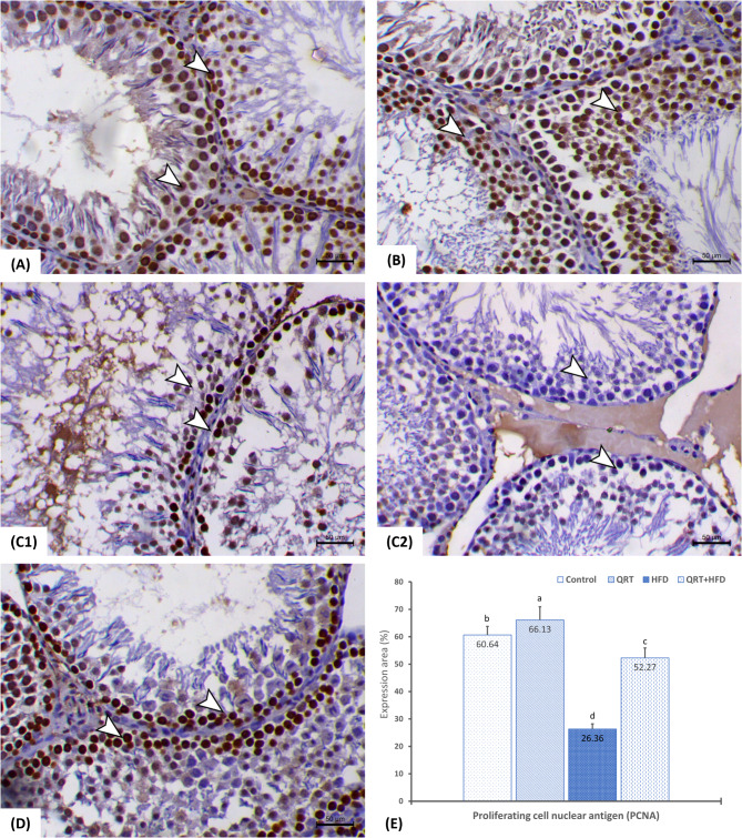 Quercetin-mediated restoration of high-fat diet-induced male reproductive dysfunction through modifying spermatogenesis and unraveling 3β-HSD, 17β-HSD, and StAR pathways.