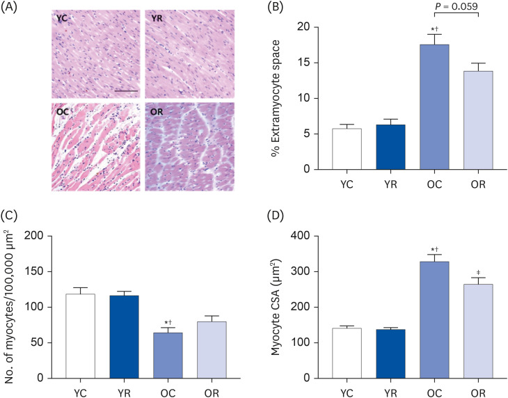 Resveratrol attenuates aging-induced mitochondrial dysfunction and mitochondria-mediated apoptosis in the rat heart.
