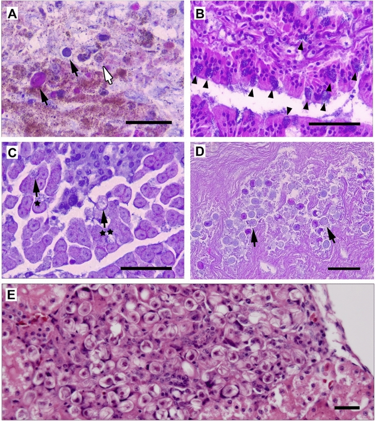Morphological and molecular description of a novel species of Eimeria (Apicomplexa) that infects extraintestinal tissues of kiwi (Aves: Apteryx spp.).