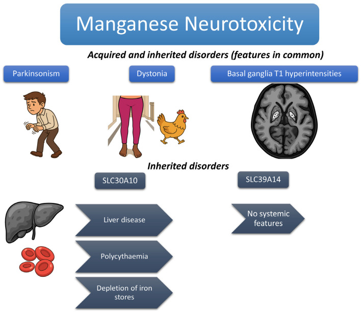 Manganese Neurotoxicity: A Comprehensive Review of Pathophysiology and Inherited and Acquired Disorders.