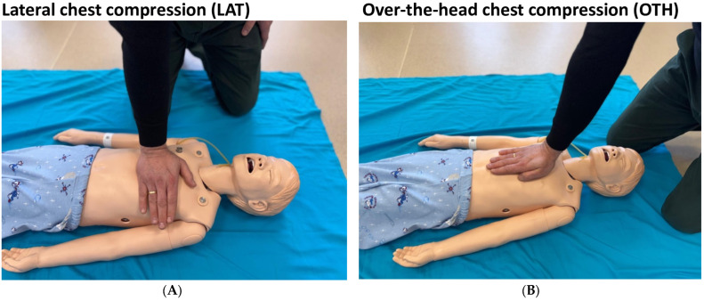 Optimizing Pediatric Chest Compressions: A Randomized Crossover Simulation Trial of Over-the-Head vs. Lateral Techniques.