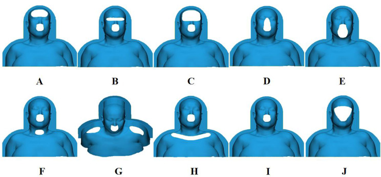 The investigation of opening modes of head and neck thermoplastic mask for radiotherapy based on finite element analysis.