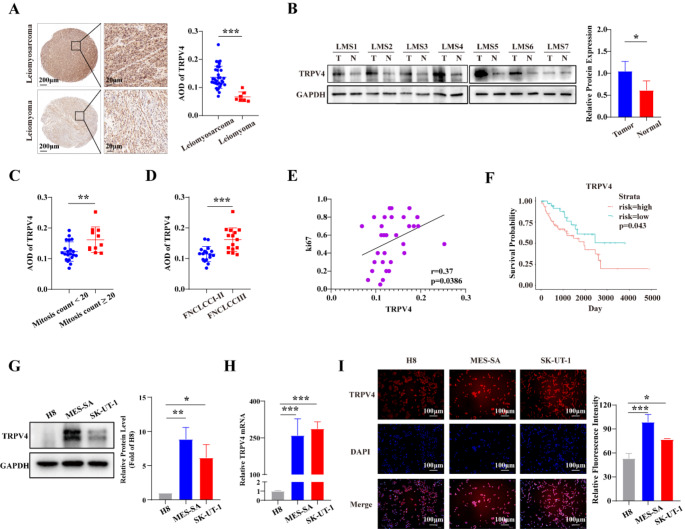 TRPV4 drives the progression of leiomyosarcoma by promoting ECM1 generation and co-activating the FAK/PI3K/AKT/GSK3β pathway.