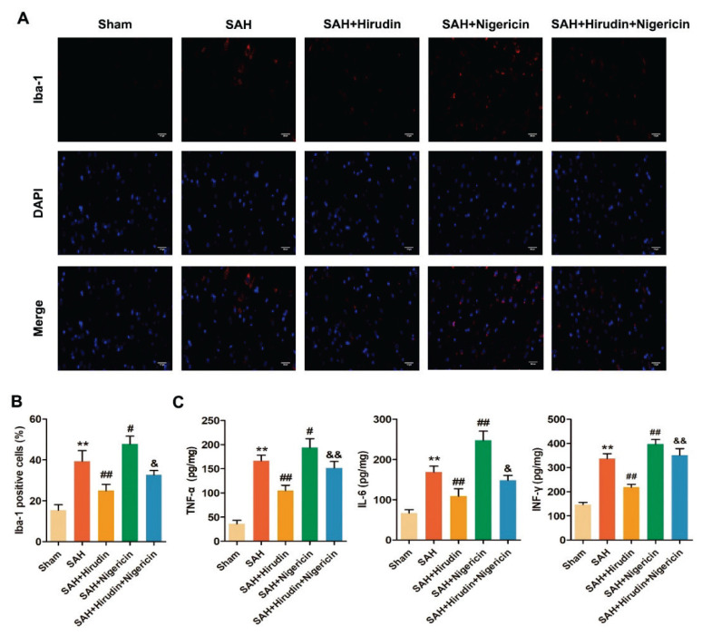 Hirudin Alleviates Early Brain Injury After Subarachnoid Hemorrhage in Rats via Regulating NLRP3 Inflammasome-Mediated Pyroptosis.