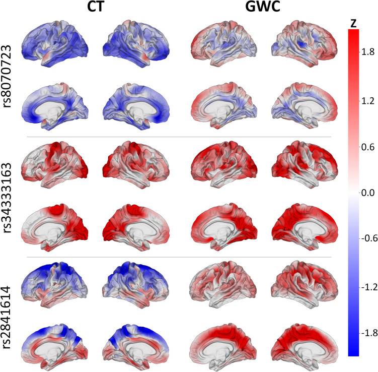 Genetic Insights into Brain Morphology: a Genome-Wide Association Study of Cortical Thickness and T<sub>1</sub>-Weighted MRI Gray Matter-White Matter Intensity Contrast.