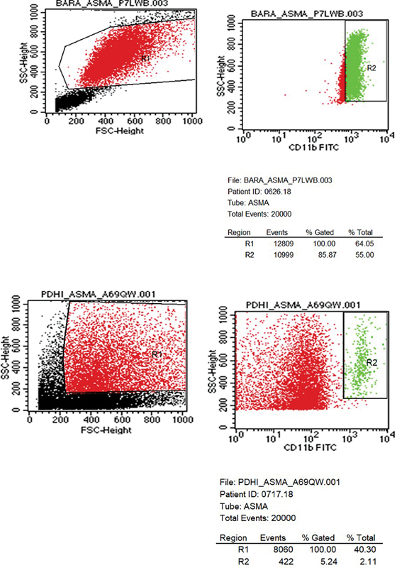 CD11b Expression Level Measurement to Distinguish Asthma Phenotype in Pediatric Patients.
