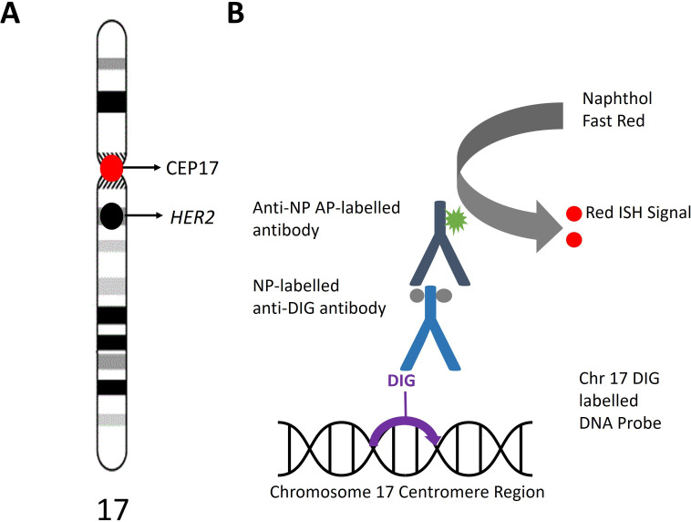 Novel scoring system provides high separation of diploidy and triploidy to aid partial hydatidiform mole diagnosis: an adaption of <i>HER2</i> D-DISH for ploidy analysis.