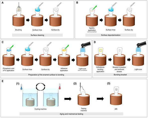 Enamel Deproteinization with Sodium Hypochlorite: Effects on Ceramic Bracket Bond Strength.