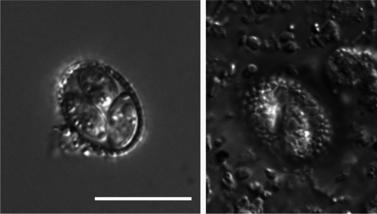 Morphological and molecular description of a novel species of Eimeria (Apicomplexa) that infects extraintestinal tissues of kiwi (Aves: Apteryx spp.).