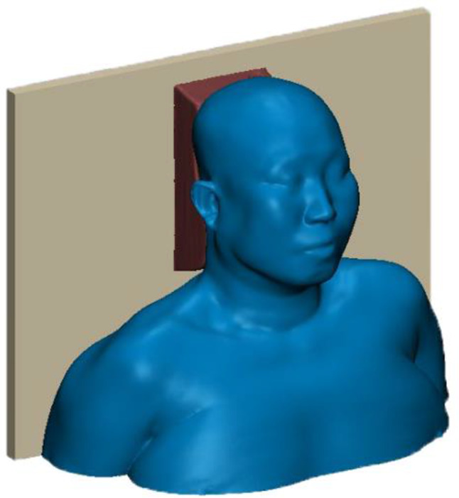 The investigation of opening modes of head and neck thermoplastic mask for radiotherapy based on finite element analysis.