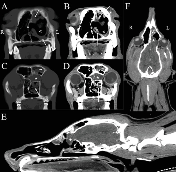 Computed Tomographic and Magnetic Resonance Imaging Diagnosis of Concurrent Sinonasal Aspergillosis and Meningoencephalocele in a Dog.