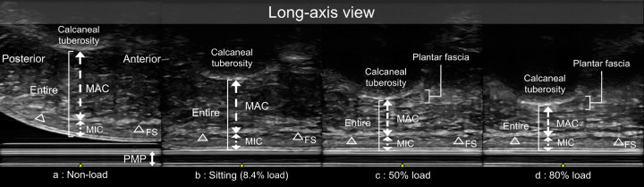 Morphological characteristics of the heel fat pad in the dominant and non-dominant feet under varying loads.