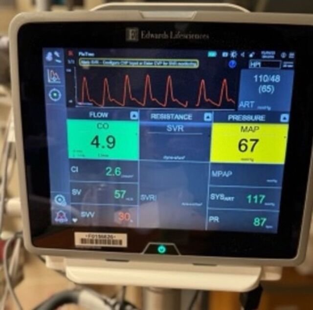 Invasive and non-invasive monitoring in the ICU.