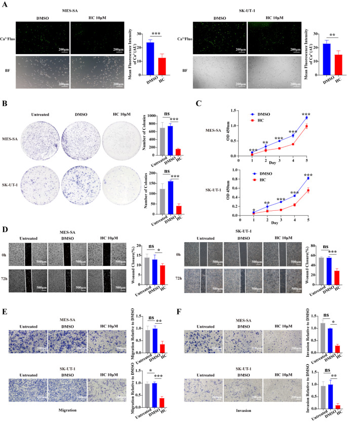 TRPV4 drives the progression of leiomyosarcoma by promoting ECM1 generation and co-activating the FAK/PI3K/AKT/GSK3β pathway.