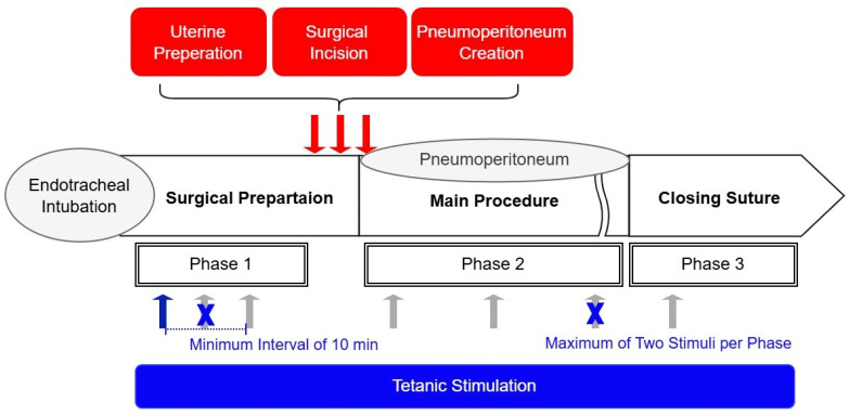 The Analgesia Nociception Index's Performance During Remimazolam-Based General Anesthesia: A Prospective Observational Study.