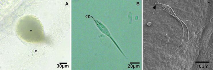 Multiparasitism by myxozoans in Pygocentrus nattereri (Characiformes: Serrasalmidae) from Sacaizal Lake, in the municipality of Pracuúba, state of Amapá, Brazil.