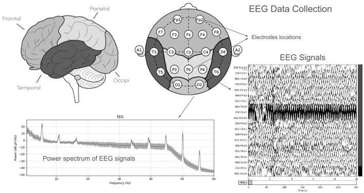 Decentralized EEG-based detection of major depressive disorder via transformer architectures and split learning.